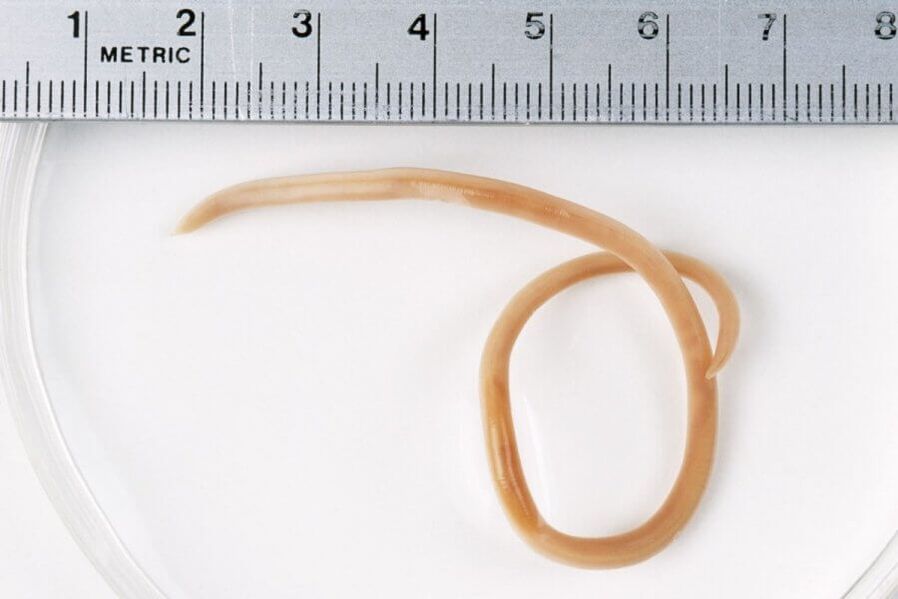 pinworm z lidského těla