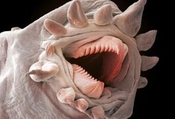 jací červi mohou žít v lidském těle