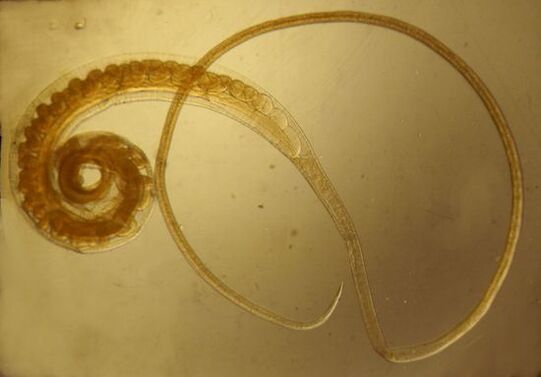 Trichinella červ z lidského těla